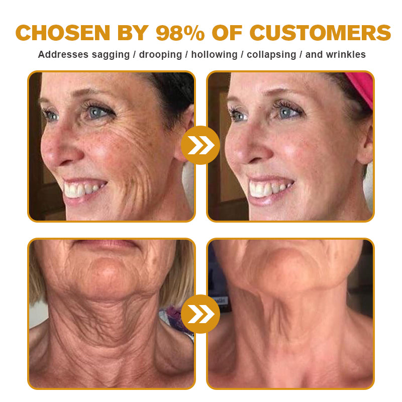 🍀👨‍⚕️Made and Shipped from the USA✅Furzero™ Botox Bee Venom Wrinkle Removal Cream-Last Day Promotion 70% OFF
