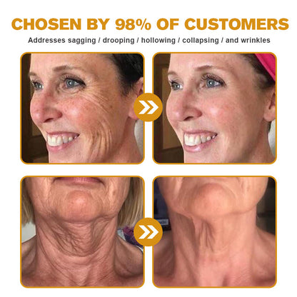 🍀👨‍⚕️Made and Shipped from the USA✅Furzero™ Botox Bee Venom Wrinkle Removal Cream-Last Day Promotion 70% OFF
