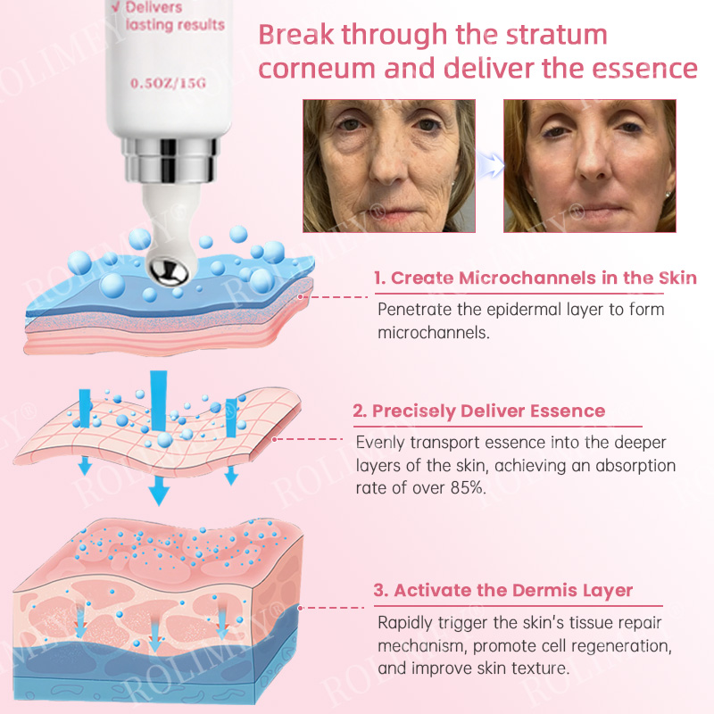 👨‍⚕️🛡️Made and Shipped from USA✅Rolimey®Botox & Stem Cell Firming Anti-Wrinkle Cream Last Day 70% OFF!