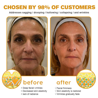 🍀👨‍⚕️Made and Shipped from the USA✅Furzero™ Botox Bee Venom Wrinkle Removal Cream-Last Day Promotion 70% OFF